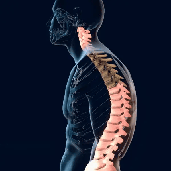 Correcteur de Posture™️ 7000 cfa