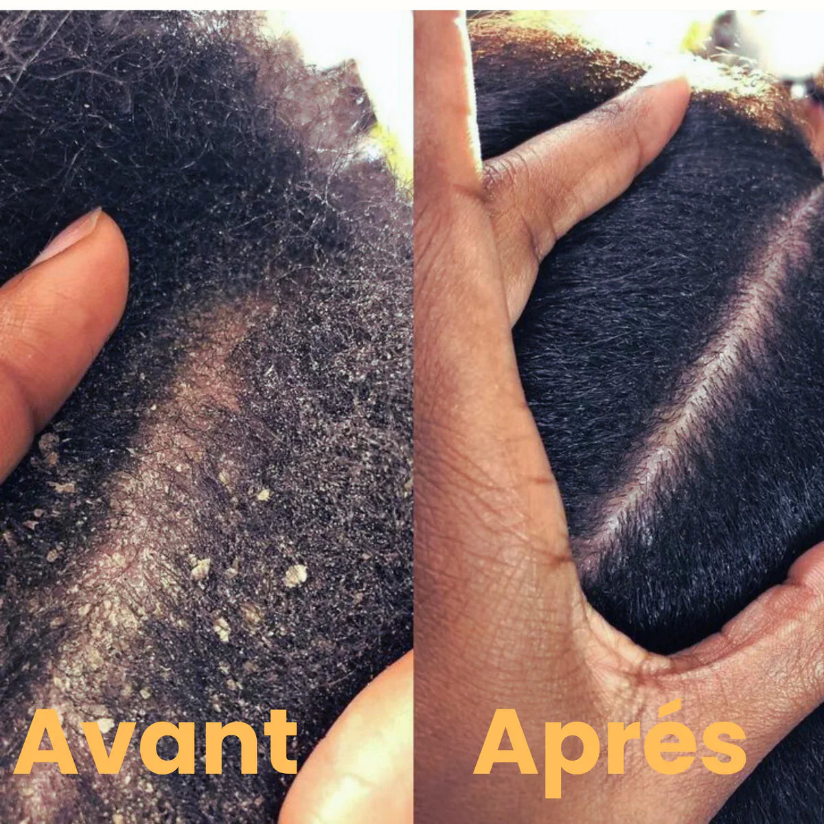 Huile de Batana 5500cfa