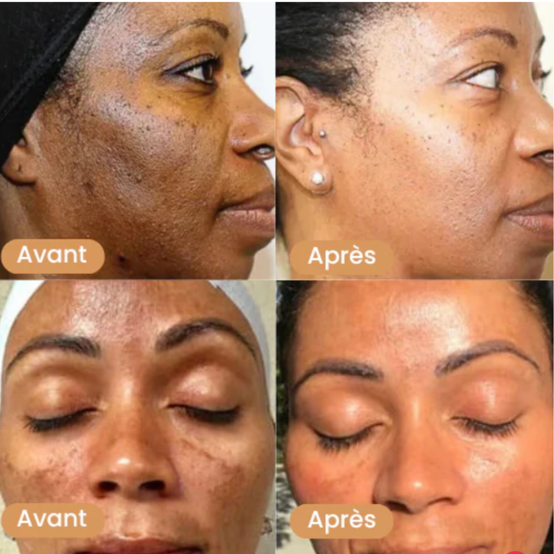 Nettoyant visage au curcuma™️ 5000CFA