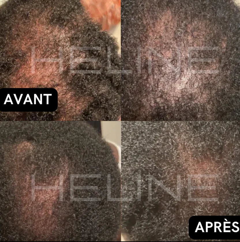 Huile de Batana 5500cfa