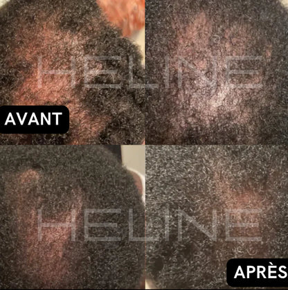 Huile de Batana 5500cfa