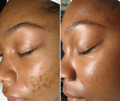 Nettoyant visage au curcuma™️ 5000cfa