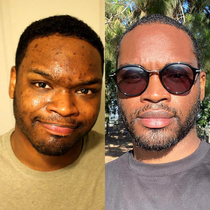 Nettoyant visage au curcuma™️ 5000cfa